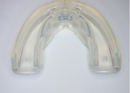 マウスピース矯正